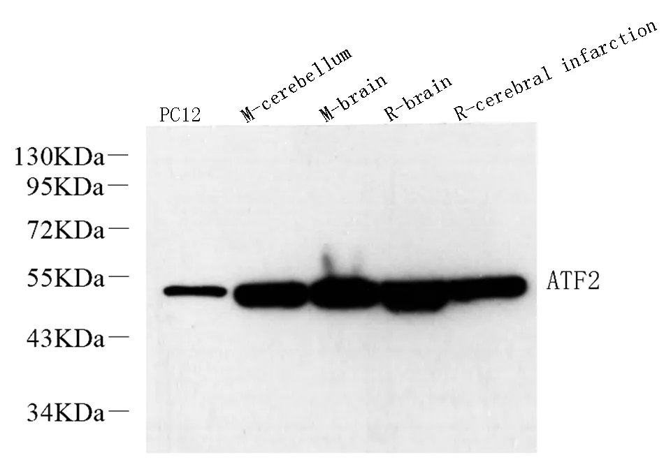 ATF2 Polyclonal Antibody - image 1