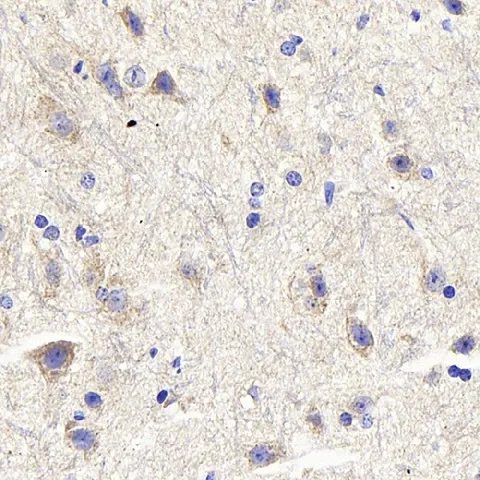 DLL3 Polyclonal Antibody - image 1