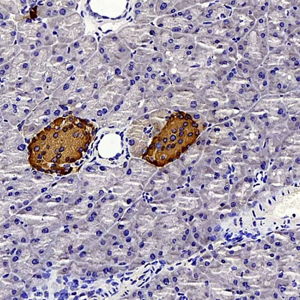 Insulin Polyclonal Antibody - image 1