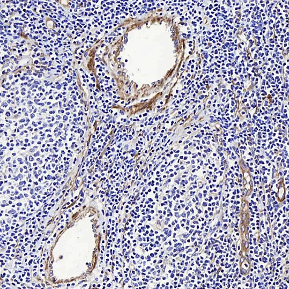 LDLR Polyclonal Antibody - image 1