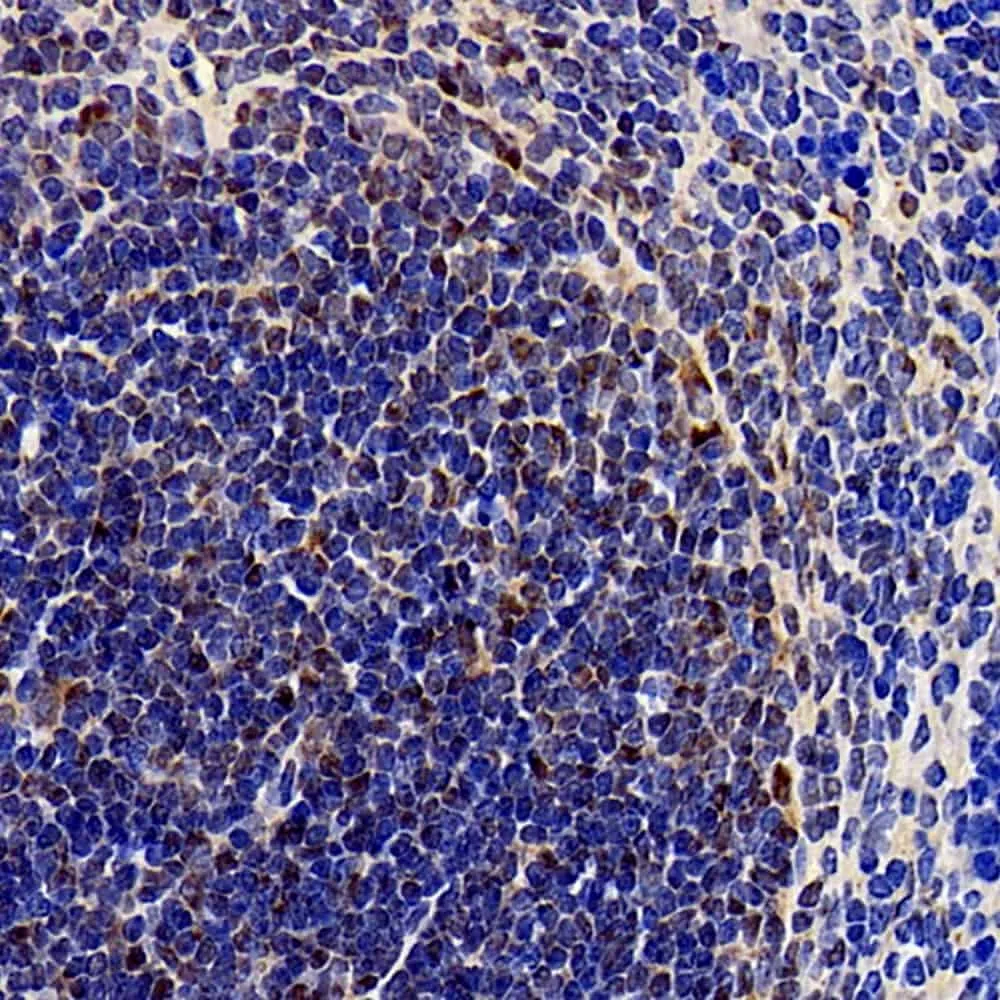 SOCS1 Polyclonal Antibody - image 1