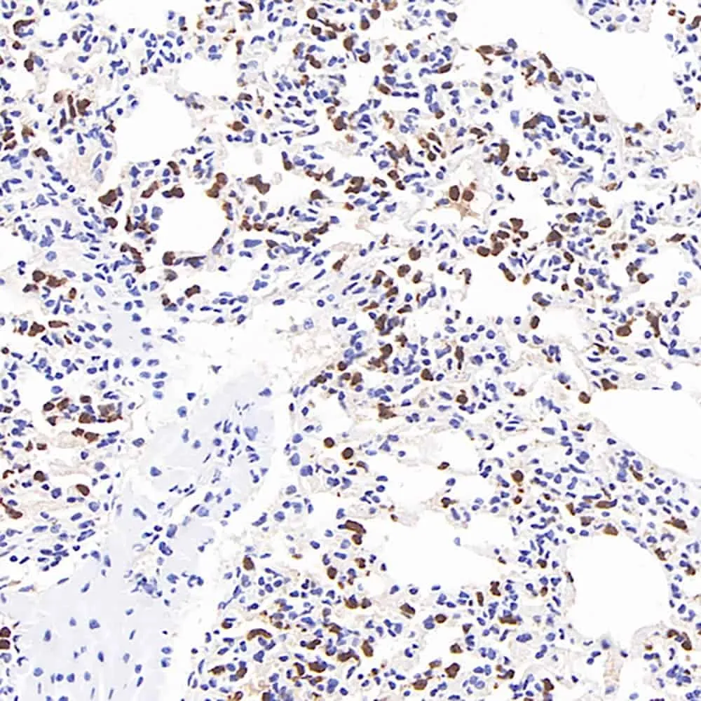 MMP9 Monoclonal Antibody - image 1