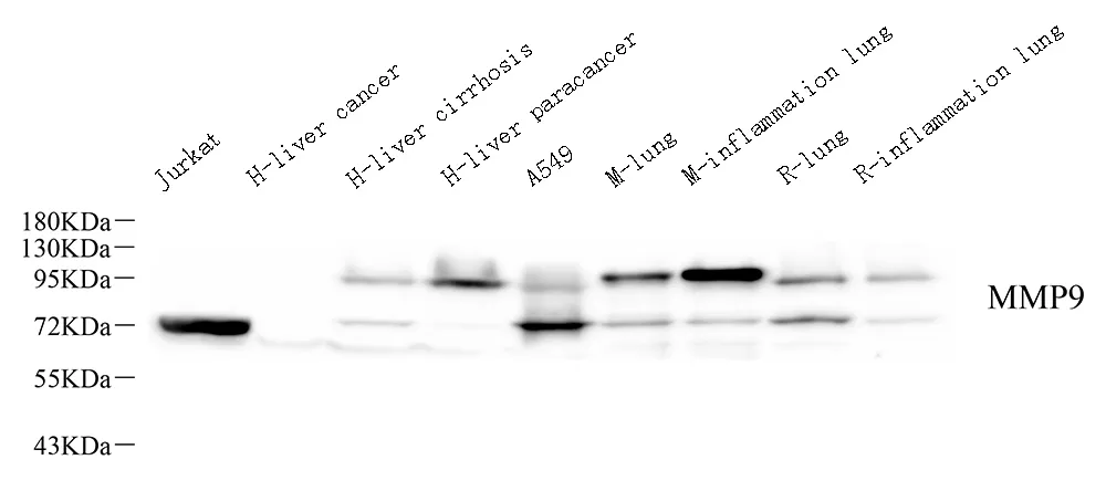 MMP9 Monoclonal Antibody - image 1