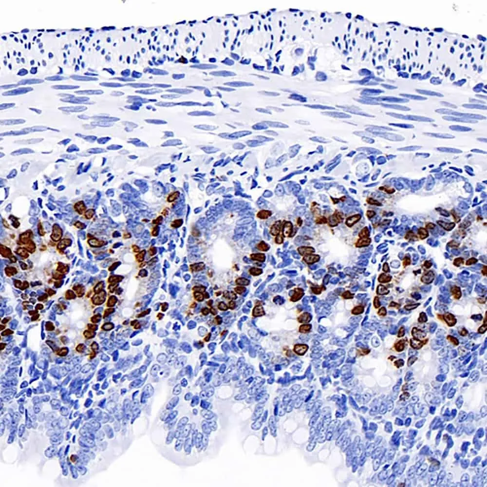 Brdu Monoclonal Antibody - image 1