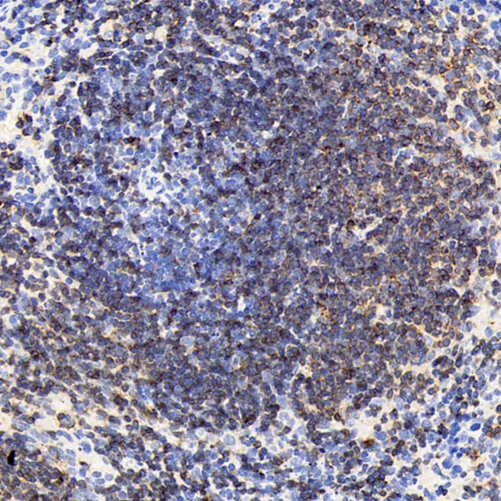 CD19 Polyclonal Antibody - image 1