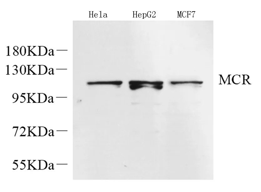 Mineralocorticoid receptor Polyclonal Antibody - image 1