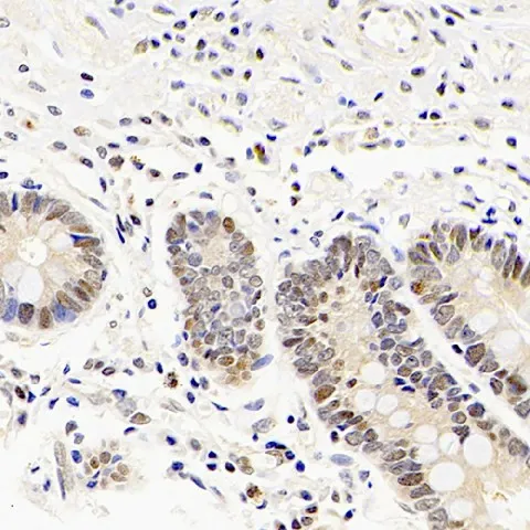 Mineralocorticoid receptor Polyclonal Antibody - image 1