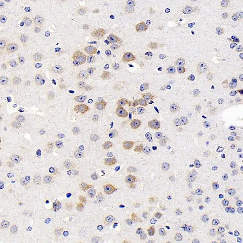 GRIN2B Polyclonal Antibody - image 1