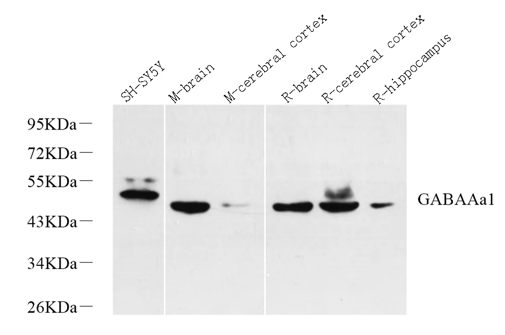 GABAA Receptor alpha1 Polyclonal Antibody - image 1