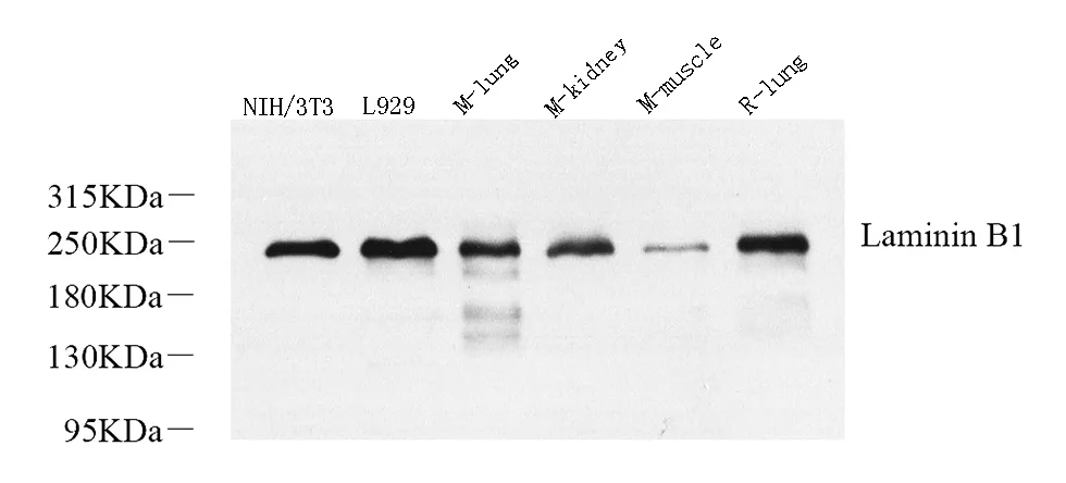 Laminin beta1 Polyclonal Antibody - image 1