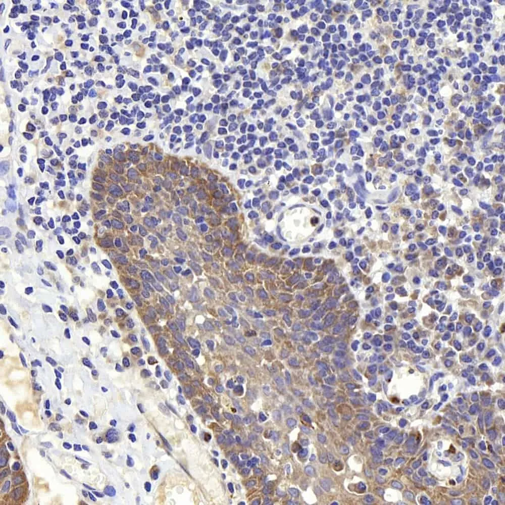 PERK Polyclonal Antibody - image 1