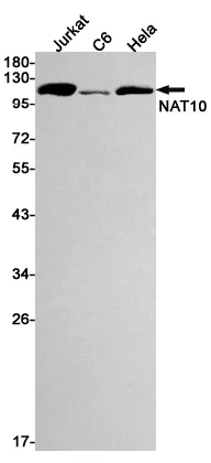 Recombinant NAT10 Monoclonal Antibody - image 1