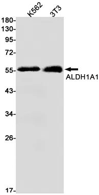 Recombinant ALDH1A1 Monoclonal Antibody - image 1