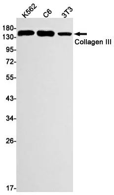 Recombinant Collagen III alpha 1 Monoclonal Antibody - image 1