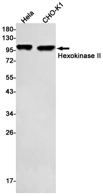 Recombinant Hexokinase II Monoclonal Antibody - image 1
