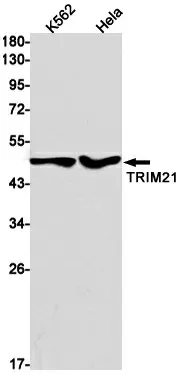 Recombinant TRIM21 Monoclonal Antibody - image 1