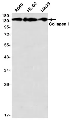 Recombinant Collagen I alpha 1 Monoclonal Antibody - image 1