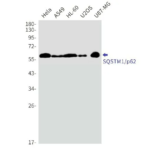Recombinant SQSTM1/p62 Monoclonal Antibody - image 1