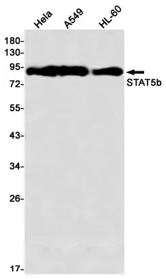 Recombinant STAT5b Monoclonal Antibody - image 1