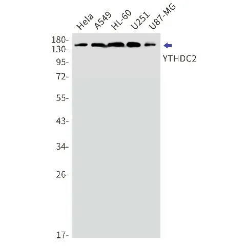 Recombinant YTHDC2 Monoclonal Antibody - image 1