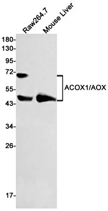 Recombinant ACOX1 Monoclonal Antibody - image 1