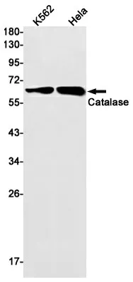 Recombinant Catalase Monoclonal Antibody - image 1