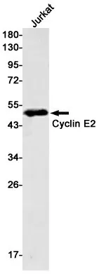 Recombinant Cyclin E2 Monoclonal Antibody - image 1