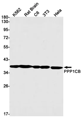 Recombinant PP1C beta Monoclonal Antibody - image 1