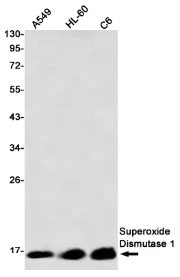 Recombinant Superoxide Dismutase 1 Monoclonal Antibody - image 1