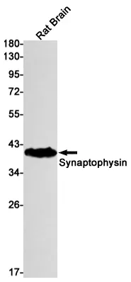 Recombinant Synaptophysin Monoclonal Antibody - image 1