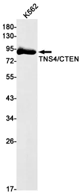 Recombinant Tensin 4 Monoclonal Antibody - image 1