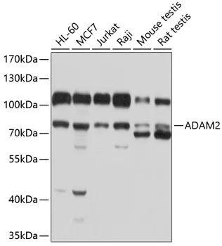 ADAM2 Polyclonal Antibody - image 1