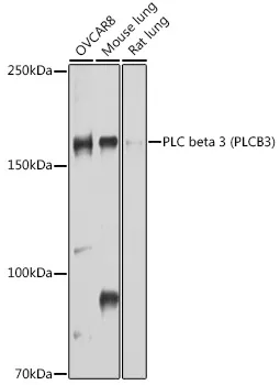 PLC beta 3 Polyclonal Antibody - image 1
