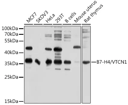 B7-H4/VTCN1 Polyclonal Antibody - image 1