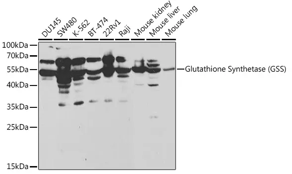 Glutathione Synthetase Polyclonal Antibody - image 1