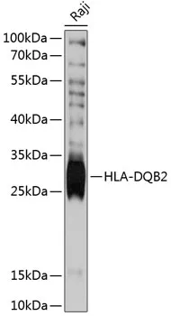 HLA-DQB2 Polyclonal Antibody - image 1