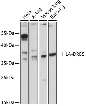 HLA-DRB5 Polyclonal Antibody - image 1