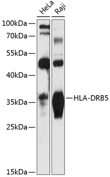 HLA-DRB5 Polyclonal Antibody - image 1