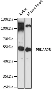 PRKAR2B Polyclonal Antibody - image 1