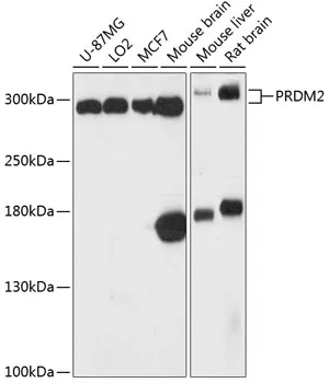 PRDM2 Polyclonal Antibody - image 1