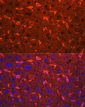 Ceruloplasmin Polyclonal Antibody - image 1