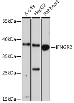 IFNGR2 Polyclonal Antibody - image 1