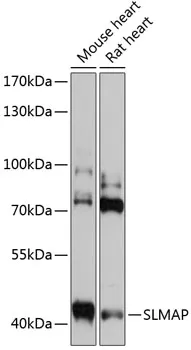 SLMAP Polyclonal Antibody - image 1