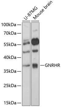 GNRHR Polyclonal Antibody - image 1