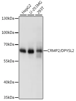 (KO Validated) CRMP2/DPYSL2 Polyclonal Antibody - image 1