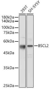 BSCL2 Polyclonal Antibody - image 1