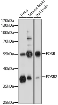 FOSB Polyclonal Antibody - image 1