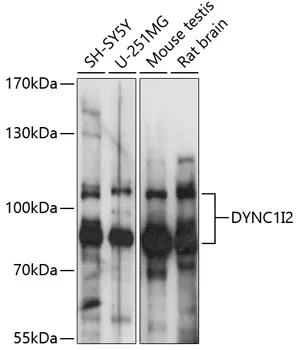 DYNC1I2 Polyclonal Antibody - image 1