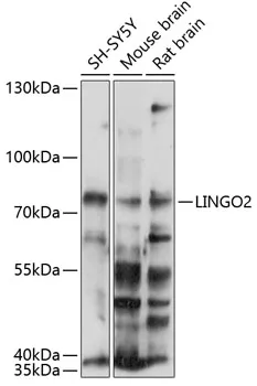 LINGO2 Polyclonal Antibody - image 1