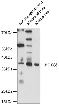 HOXC8 Polyclonal Antibody - image 1